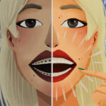 woman comparing clear aligners vs braces in jonesboro